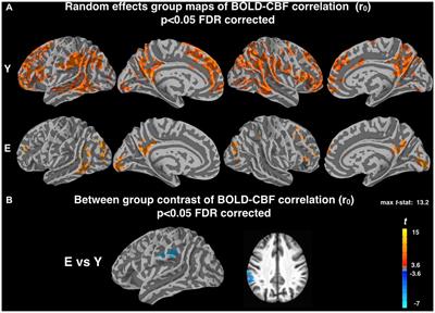 Reduced <mark class="highlighted">Dynamic Coupling</mark> Between Spontaneous BOLD-CBF Fluctuations in Older Adults: A Dual-Echo pCASL Study